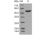 Recombinant Human 14-3-3 beta/YWHAB Protein (GST Tag)