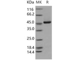 Recombinant Human KYNU/Kynureninase Protein (His Tag)(Active)