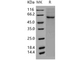 Recombinant Human GRK5/GPRK5 Protein (His Tag)