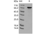 Recombinant Human HPRG/HRG Protein (His Tag)(Active)