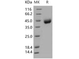 Recombinant Human SCARB3 Protein (His Tag)(Active)