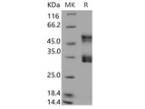 Recombinant Human Urokinase/uPA Protein (His Tag)(Active)