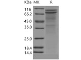 Recombinant Human DSC2/Desmocollin-2 Protein (His Tag)