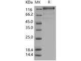 Recombinant Human VEGFR3/FLT4 Protein (His Tag)(Active)