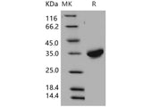 Recombinant Human CXADR/CAR Protein (His Tag)(Active)