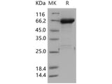 Recombinant Human JNK1/MAPK8 Protein (GST Tag)