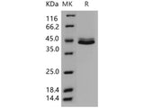 Recombinant Human CCD5L Protein (His Tag) 