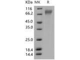 Recombinant Human CD30/TNFRSF8 Protein (His Tag)(Active)