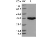 Recombinant Human PSA/KLK3 Protein (His Tag)(Active)