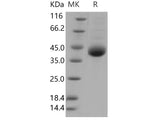 Recombinant Human Kallikrein 11/KLK11 Protein (His Tag)(Active)