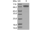 Recombinant Human EphB2 Protein (His Tag)(Active)