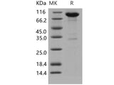 Recombinant Human EphB2 Protein (His & Fc Tag)(Active)