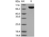 Recombinant Human MICB Protein (His & Fc Tag)(Active)