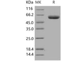 Recombinant Human DPP7/DPPII/DPP2 Protein (His Tag)