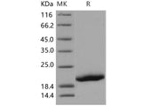 Recombinant Human GP1BB/CD42c Protein (His Tag)