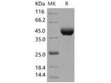 Recombinant Human LRAP/ERAP2 Protein (His Tag)(Active)