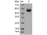 Recombinant Human DDR1 Kinase/MCK10 Protein (His Tag)