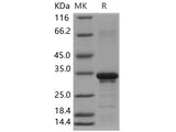 Recombinant Human Beta-amyloid 38/Beta-APP38 Protein (aa 672-709, His & GST Tag)