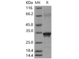 Recombinant Human Beta-amyloid 39/Beta-APP39 Protein (aa 672-710, His & GST Tag)