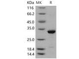 Recombinant Human Beta-amyloid 40/Beta-APP40 Protein (His&GST Tag)(Active)