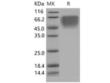 Recombinant Human CD86/B7-2 Protein (aa 1-239,His Tag)(Active)