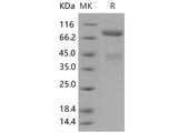 Recombinant Human c-MET/HGFR Protein (His Tag)(Active)