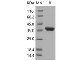 Recombinant Human Carbonic Anhydrase 10/CA10 Protein (His Tag)(Active)