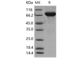 Recombinant Human TH/Tyrosine Hydroxylase Protein (His Tag)