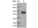 Recombinant Human sFRP1/SARP2 Protein (His Tag)(Active)