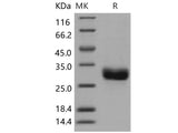 Recombinant Human ULBP1/N2DL1 Protein (His Tag)(Active)