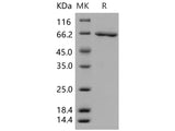 Recombinant Human SerpinB2/PAI-2 Protein (GST Tag)(Active)