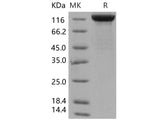 Recombinant Human LIFR/CD118 Protein (His Tag)(Active)