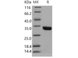 Recombinant Human CDK2 Protein (Baculovirus, His Tag)