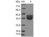 Recombinant Human TNFRSF17/BCMA Protein (Fc Tag)