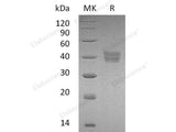 Recombinant Human HtrA2/Omi Protein (His Tag)(Active)