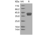 Recombinant Human Carbonic Anhydrase XII/CA12 Protein (His Tag)(Active)