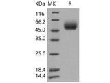 Recombinant Human FGFR1/CD331 Protein (His Tag)(Active)