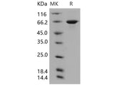 Recombinant Human USH1C/Harmonin Protein (His Tag)