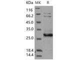 Recombinant Human XIAP/BIRC4 Protein (AVI Tag)(Active)