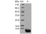 Recombinant Human Complement C5a Protein (Active)