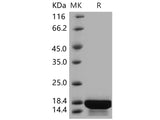 Recombinant Human Interleukin-21/IL-21 Protein (Active)