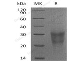 Recombinant Human NKG2D/CD314 Protein (aa 78-216, His Tag)(Active)