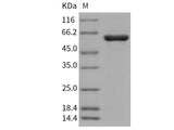 Recombinant Human PTPN2/PTPT Protein (His & GST Tag)(Active)