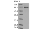 Recombinant Human TGFBI/BIGH3 Protein (His Tag)