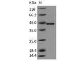 Recombinant Human TCN2 Protein (His Tag)