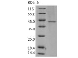 Recombinant Human TCN2 Protein (His Tag)(Active)