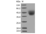 Recombinant Human CD226/DNAM-1 Protein (His Tag)(Active)