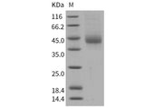 Recombinant Human TFPI Protein (His Tag)(Active)