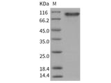 Recombinant Human PDGFRa/CD140a Protein (His Tag)(Active)