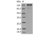 Recombinant Human PDGFRa/CD140a Protein (Fc Tag)(Active)